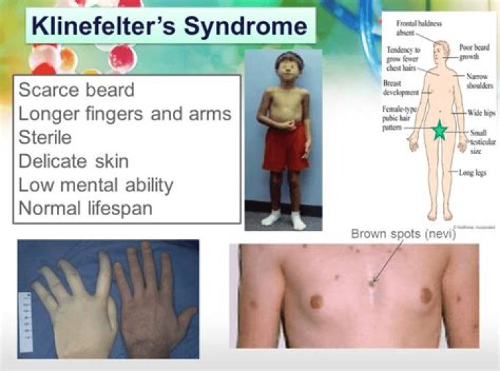 Is goldfield syndrome real