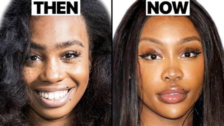 Kimbella Before Plastic Surgery: How Did The ‘Love & Hip Hop: New York’ Star Look Before Botox, Fillers, Lipo and BBL? Check Out Her Before and After Pictures!