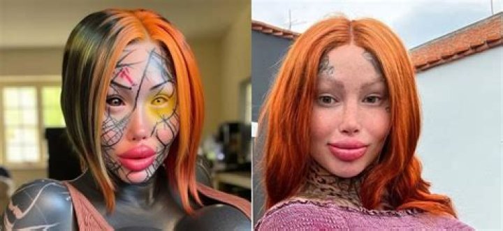 Mary Magdalene Model Before and After Surgery: Meet Her On Instagram